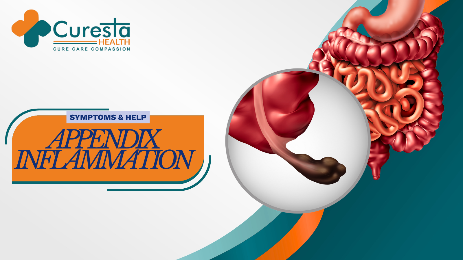 Appendix Inflammation Symptoms & Help 