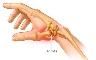 Types of General & Minimally Invasive Surgeries We Offer