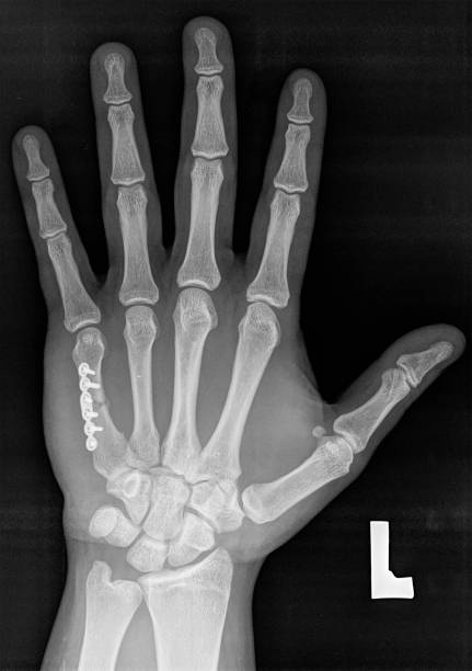 Precision Imaging, Accurate Diagnosis